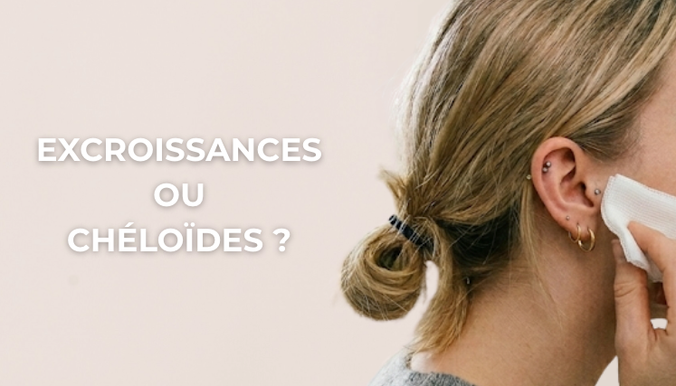Chéloïdes, Excroissances après Piercing : Comment les soigner ?